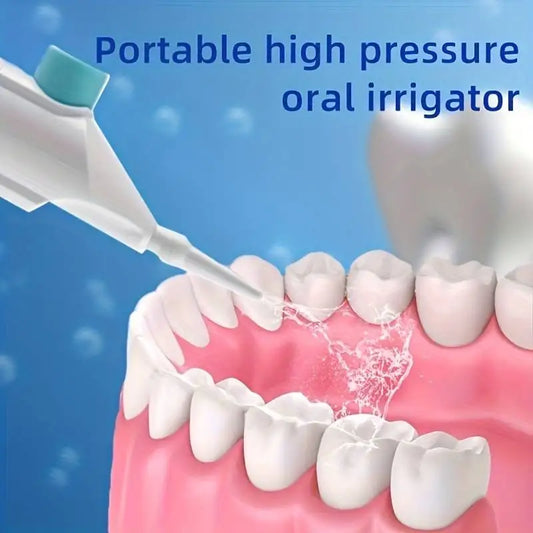 High Pressure Dental Water Pick – Portable & Effective